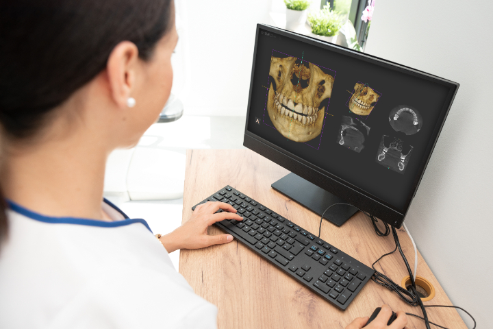 3DCTを確認する歯科医師