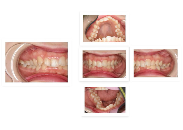 img-case02-bf