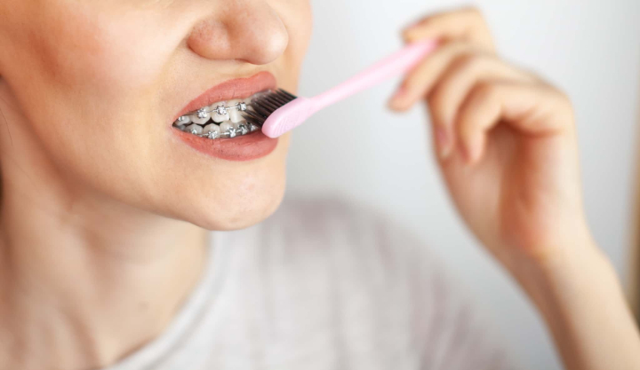 ワイヤー矯正中に痛みを感じることがある歯みがきをするイメージ