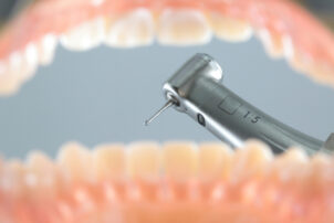 矯正で歯を削るイメージ