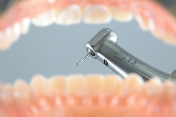 矯正で歯を削るイメージ