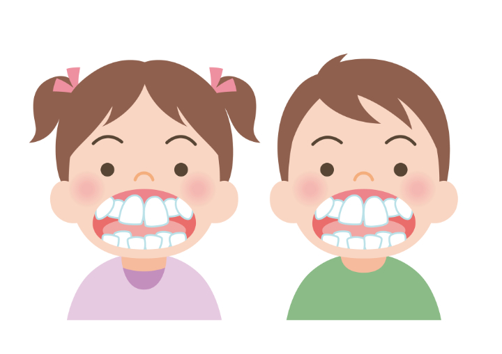 出っ歯の子どものイラスト