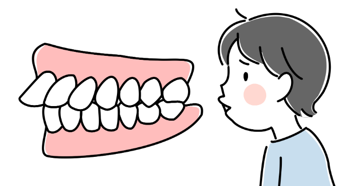 出っ歯の子どもの歯