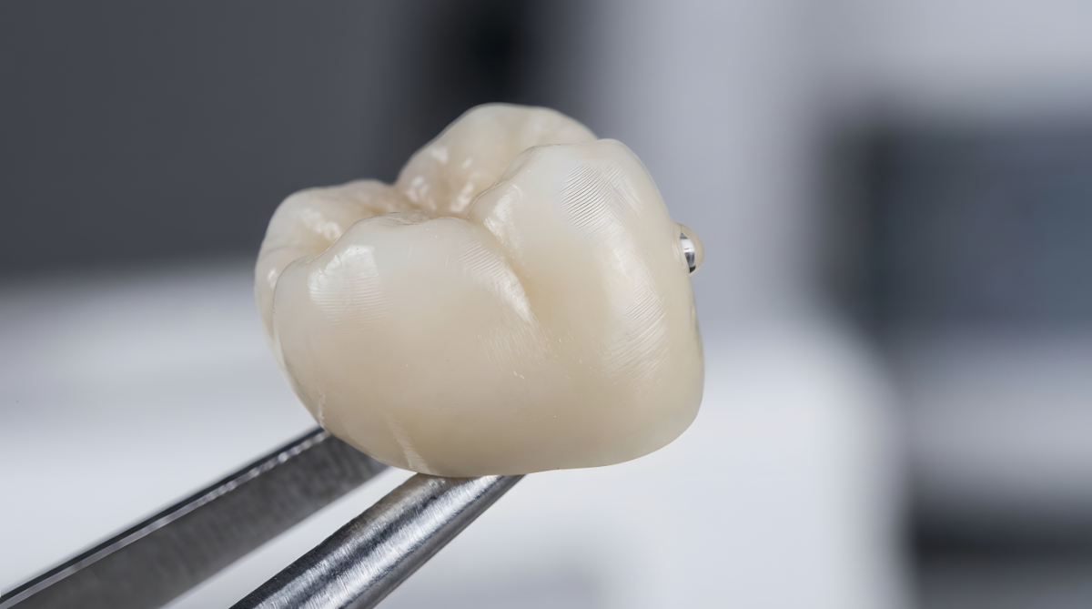 セラミックの歯